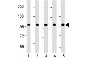 Western blot testing of LGR-5 antibody at 1:2000 dilution.