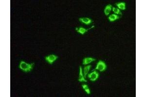 Detection of Hsp60 in Hela cells using Polyclonal Antibody to Heat Shock Protein 60 (Hsp60)