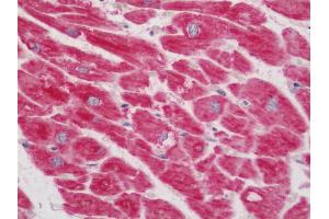 Human Heart: Formalin-Fixed, Paraffin-Embedded (FFPE).