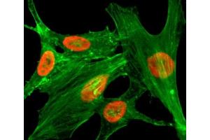 ICC/IF staining of HeLa cells treated with sodium butyrate using recombinant H2A. (Recombinant H2AFZ anticorps  (acLys4))