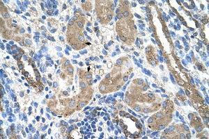 Image no. 1 for anti-Cytochrome P450, Family 2, Subfamily D, Polypeptide 6 (CYP2D6) (AA 101-150) antibody (ABIN204973)