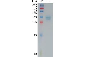 Human C(144-156) Protein, hFc Tag on SDS-PAGE under reducing condition.