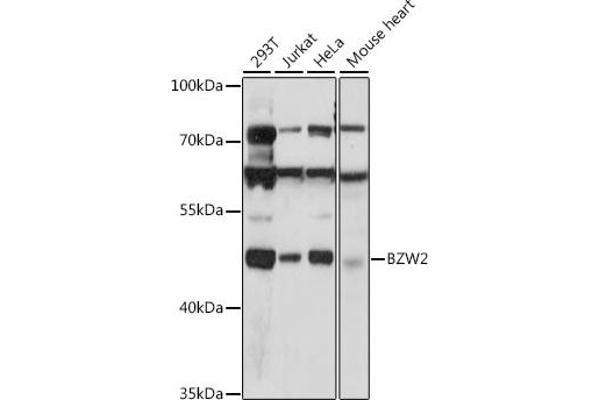 BZW2 抗体  (AA 190-300)