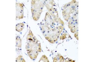 Immunohistochemistry of paraffin-embedded human gastric using YAP1 antibody at dilution of 1:100 (x40 lens). (YAP1 anticorps)