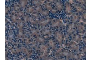 Detection of SOD2 in Mouse Kidney Tissue using Polyclonal Antibody to Superoxide Dismutase 2, Mitochondrial (SOD2)
