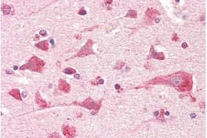 anti-Prostaglandin E Synthase 2 (PTGES2) (AA 292-306) antibody