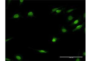 Immunofluorescence of monoclonal antibody to HNF4A on HeLa cell. (HNF4A anticorps  (AA 324-423))