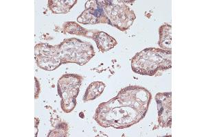 Immunohistochemistry of paraffin-embedded human placenta using GEMIN5 antibody (ABIN7267367) at dilution of 1:100 (40x lens).