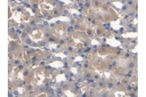 Detection of TMEM27 in Mouse Kidney Tissue using Monoclonal Antibody to Transmembrane Protein 27 (TMEM27) (TMEM27 anticorps  (AA 12-222))