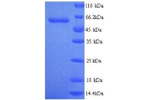 Glypican 6 (GPC6) (AA 24-529) protein (His tag)