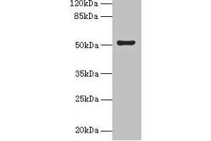 Western blot All lanes: SLC46A3 antibody at 4 μg/mL + Jurkat whole cell lysate Secondary Goat polyclonal to rabbit IgG at 1/10000 dilution Predicted band size: 52, 43 kDa Observed band size: 52 kDa (SLC46A3 anticorps  (AA 26-73))