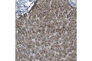 Immunohistochemical staining of human liver with SVOPL polyclonal antibody  shows moderate cytoplasmic positivity in hepatocytes at 1:50-1:200 dilution. (SVOPL anticorps)