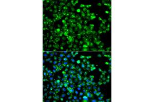 Immunofluorescence analysis of A549 cells using CAPN5 antibody (ABIN5975527). (Calpain 5 anticorps)