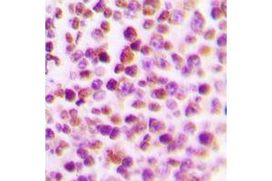 Immunohistochemical analysis of E2F4 staining in human tonsil formalin fixed paraffin embedded tissue section.