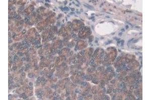 Detection of ASPN in Mouse Stomach Tissue using Polyclonal Antibody to Asporin (ASPN) (Asporin anticorps  (AA 16-373))