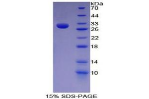 SDS-PAGE (SDS) image for Nestin (NES) (AA 178-399) protein (His tag) (ABIN2126035)