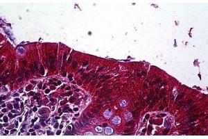 Human Colon, Epithelium: Formalin-Fixed, Paraffin-Embedded (FFPE) (LRP4 anticorps  (AA 1765-1777))