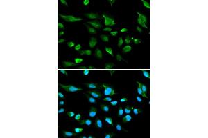 Immunofluorescence analysis of A549 cell using AIRE antibody. (AIRE anticorps)