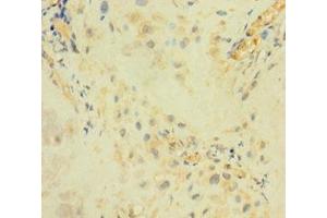 Immunohistochemistry of paraffin-embedded human placenta tissue using ABIN7144701 at dilution of 1:100 (Arylsulfatase I anticorps  (AA 301-569))