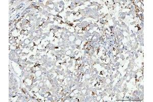 IHC analysis of CD14 using anti-CD14 antibody (ABIN3044565). (CD14 anticorps  (AA 65-327))