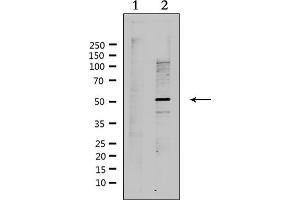 Western blot analysis of extracts from Hela, using RAD51L2 Antibody. (RAD51C anticorps  (Internal Region))