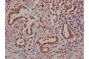 IHC image of ABIN7127859 diluted at 1:100 and staining in paraffin-embedded human lung tissue performed on a Leica BondTM system.