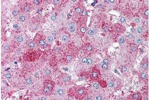 Human Liver (formalin-fixed, paraffin-embedded) stained with SUPT16H antibody ABIN239853 at 10 ug/ml followed by biotinylated anti-mouse IgG secondary antibody ABIN481714, alkaline phosphatase-streptavidin and chromogen.