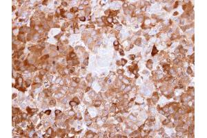 IHC-P Image Immunohistochemical analysis of paraffin-embedded CL1-0 xenograft, using NQO1, antibody at 1:500 dilution.