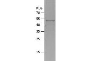 GORASP1 Protein (AA 221-440) (His tag)