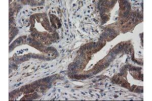 Image no. 14 for anti-Destrin (Actin Depolymerizing Factor) (DSTN) antibody (ABIN1497908)