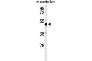 Western blot analysis of ANKH Antibody (C-term) in mouse cerebellum tissue lysates (35ug/lane). (ANKH anticorps  (C-Term))