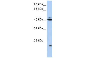WB Suggested Anti-UBD Antibody Titration:  0. (UBD anticorps  (N-Term))