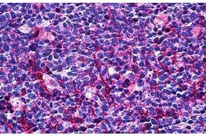 Human Tonsil: Formalin-Fixed, Paraffin-Embedded (FFPE) (CD31 anticorps  (AA 686-735))
