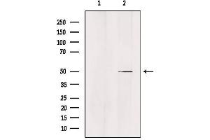 Western blot analysis of extracts from Hela, using ZFYVE19 Antibody. (ZFYVE19 anticorps  (Internal Region))