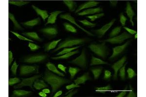 Immunofluorescence of monoclonal antibody to STIP1 on HeLa cell. (STIP1 anticorps  (AA 445-543))