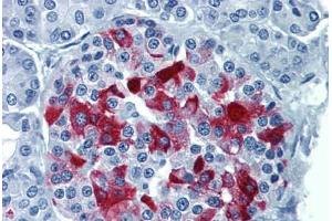 Human Pancreas: Formalin-Fixed, Paraffin-Embedded (FFPE) (RBP4 anticorps  (AA 19-202))