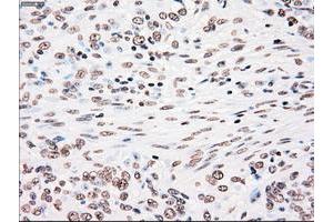 Image no. 3 for anti-Polo-Like Kinase 1 (PLK1) antibody (ABIN1500282)