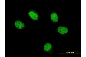 Immunofluorescence of monoclonal antibody to FOXQ1 on HeLa cell.