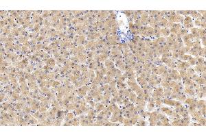 Detection of FTH in Human Liver Tissue using Monoclonal Antibody to Ferritin, Heavy Polypeptide (FTH)