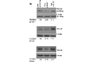 Panel A shows miR-21 expression in pre-miR-21 or anti-miR-21 transfected cells compared to control (miR-scramble) in the UT-SCC cell lines 24A, 74A, and 87.