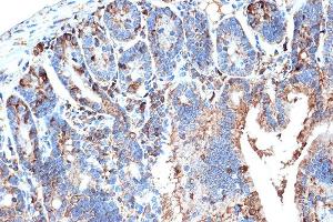 Immunohistochemistry of paraffin-embedded mouse intestin using FABPI Rabbit mAb (ABIN7267151) at dilution of 1:100 (40x lens).