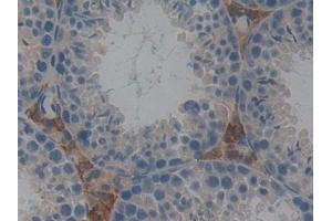 Detection of GSTt2 in Mouse Testis Tissue using Polyclonal Antibody to Glutathione S Transferase Theta 2 (GSTt2)