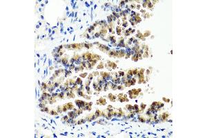 Immunohistochemistry of paraffin-embedded mouse lung using SIRT1 antibody (ABIN5970059) at dilution of 1/100 (40x lens). (SIRT1 anticorps  (C-Term))