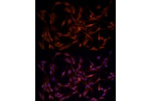 Immunofluorescence analysis of PC-12 cells using B1 Rabbit pAb (ABIN3022390, ABIN3022391, ABIN3022392, ABIN1512555 and ABIN6218779) at dilution of 1:50 (40x lens).