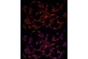 Immunofluorescence analysis of PC-12 cells using B1 Rabbit pAb (ABIN3022390, ABIN3022391, ABIN3022392, ABIN1512555 and ABIN6218779) at dilution of 1:50 (40x lens). (AKR1B1 anticorps  (AA 1-316))