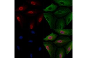 ABIN6264373 and ABIN6277684 staining  cells by IF/ICC.