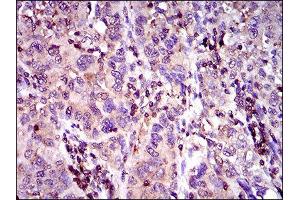 Immunohistochemistry (IHC) image for anti-ATP-Binding Cassette, Sub-Family C (CFTR/MRP), Member 4 (ABCC4) (AA 631-692) antibody (ABIN1845662)