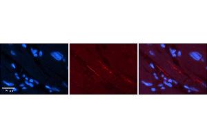 Rabbit Anti-SCN5A Antibody    Formalin Fixed Paraffin Embedded Tissue: Human Adult heart  Observed Staining: Membrane Primary Antibody Concentration: 1:100 Secondary Antibody: Donkey anti-Rabbit-Cy2/3 Secondary Antibody Concentration: 1:200 Magnification: 20X Exposure Time: 0.