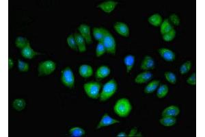 Immunofluorescent analysis of A549 cells using ABIN7144679 at dilution of 1:100 and Alexa Fluor 488-congugated AffiniPure Goat Anti-Rabbit IgG(H+L) (NAT2 anticorps  (AA 1-290))