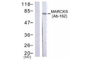 Image no. 1 for anti-Myristoylated Alanine-Rich Protein Kinase C Substrate (MARCKS) (Ser162) antibody (ABIN197519) (MARCKS anticorps  (Ser162))